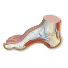 M32 Scientific Hollow Foot Pes Cavus Joint Model 099184787029