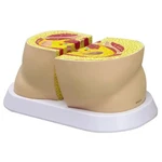 Obesity Body Fat Shape Anatomical Model Gpi Lfa #3600 See Video Make Offer!. Fixed Price $103.85.