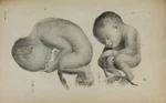 197 Antique Medical Science Books On Dvd- Midwifery Child Birth Medicine. Fixed Price $7.85.