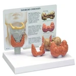 Thyroid Anatomical Model Set Gpi Lfa #3150 See Video Make Us Offer!. Fixed Price $86.95.
