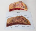 Breast Cancer Cross-section Anatomical Model Gpi No Stand. Fixed Price $24.99.
